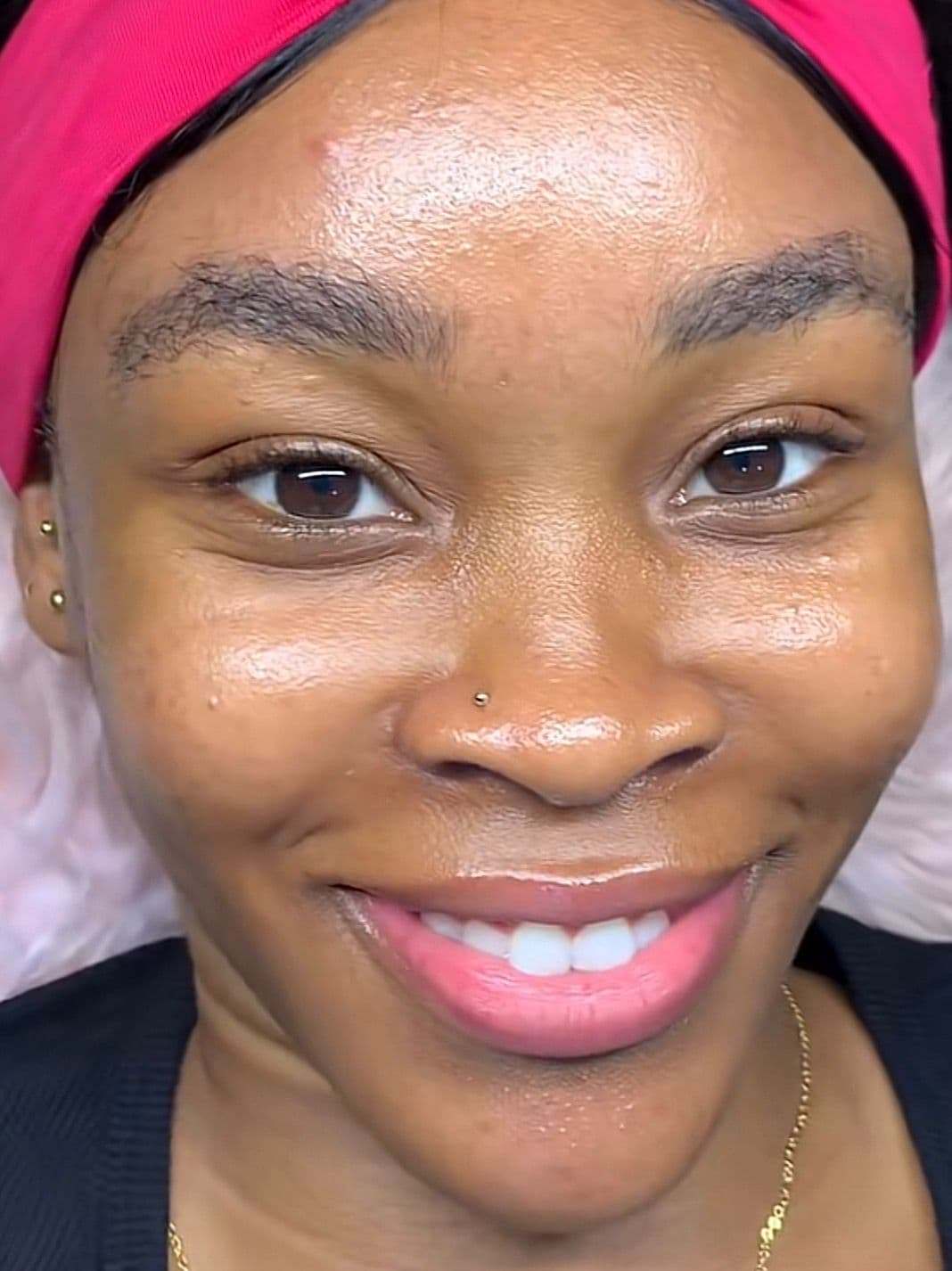 Avant — Avant et après transformation 2